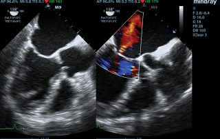 M9 Image: Dual TEE of heart using P7-3Ts