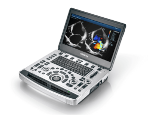 portable ultrasound technology