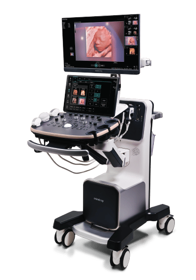 19 ultrasound transducer