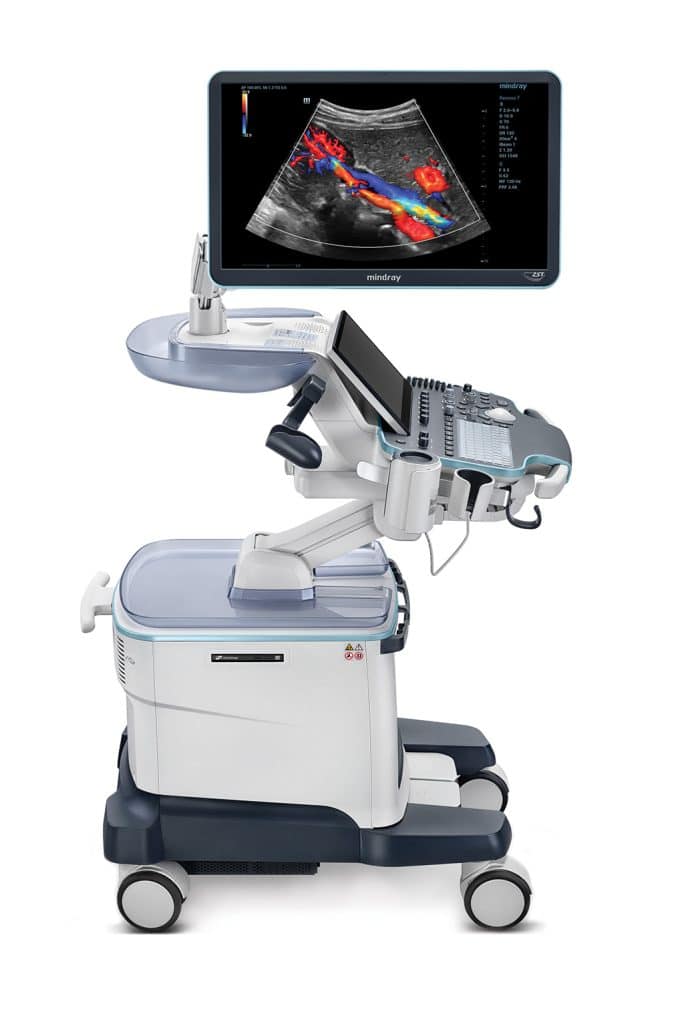 Resona 7 Ultrasound System Side View
