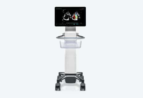 TE X Ultrasound System