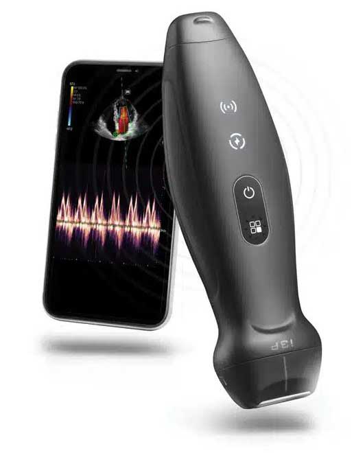 TE Air Wireless Handheld Ultrasound