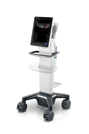 te5 ultrasound machine